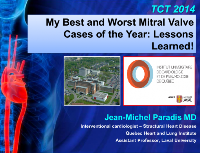 My Best and Worst Mitral Valve Cases of the Year: Lessons Learned!