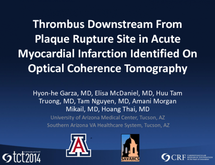 TCT 366: Thrombus Downstream From Plaque Rupture Site in Acute Myocardial Infarction Identified on Optical Coherence Tomography