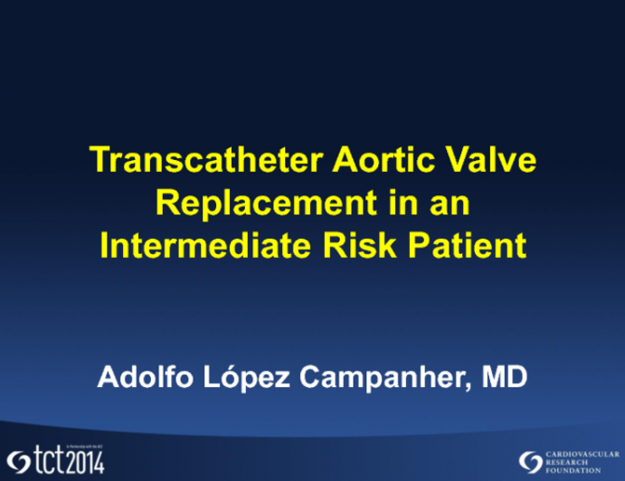 Case Presentation #2: Aortic Stenosis in an Intermediate-Risk Patient