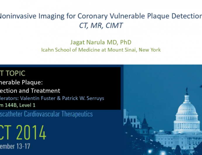 Noninvasive Imaging Modalities for Coronary VP Detection: CT, MR, and CIMT