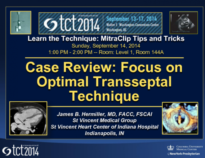 Case Review: Focus on Optimal Transseptal Technique