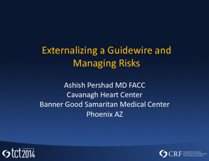 Externalizing the Guidewire and Managing the Risks