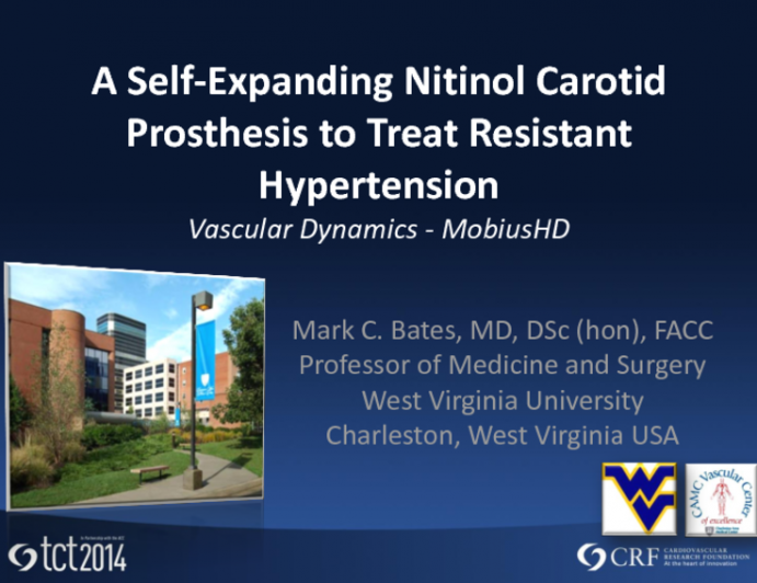 A Self-Expanding Nitinol Carotid Prosthesis to Treat Resistant Hypertension (Vascular Dynamics)