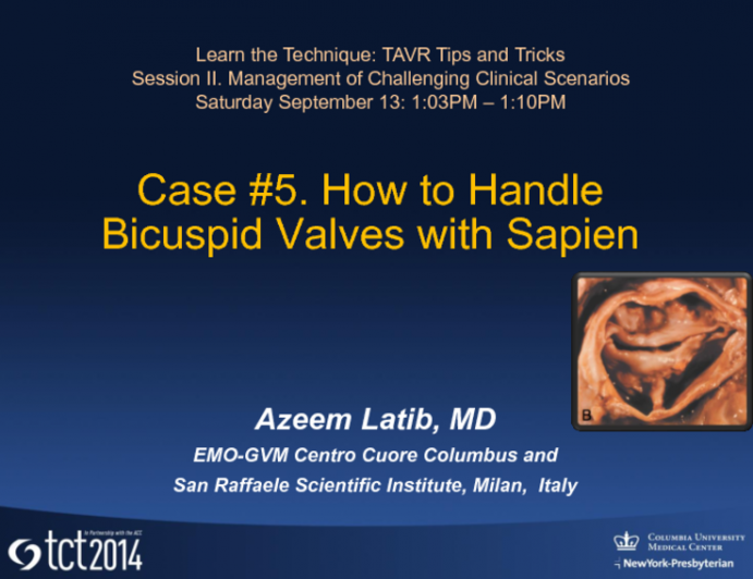 Case #5. How to Handle Bicuspid Valves with Sapien