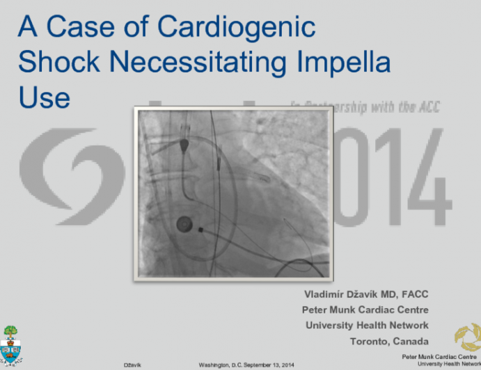 A Case of Cardiogenic Shock Necessitating Impella Use