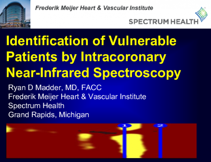 TCT 398: Identification of Vulnerable Patients by Intracoronary Near-Infrared Spectroscopy