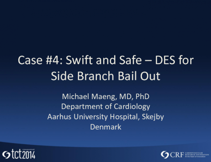 Case #4: Swift and Safe  DES for Side Branch Bail Out