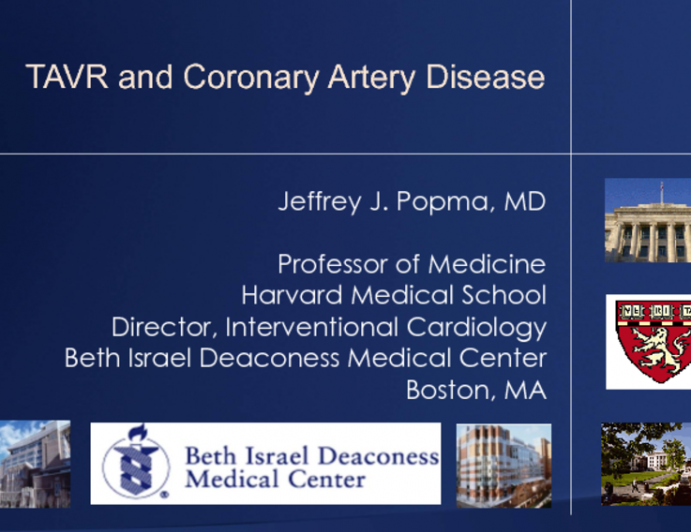 Coronary Artery Disease and TAVR: Who, When, and How to Revascularize?