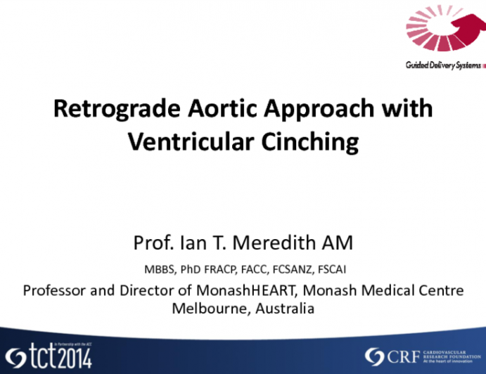 Retrograde Aortic Approach with Ventricular Cinching (Guided Delivery Systems)