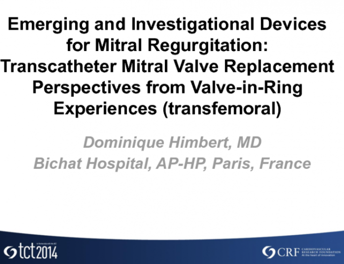 Perspectives from Valve-in-Ring Experiences (Transfemoral)