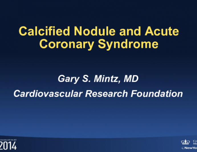 Case #2: Calcified Nodule and ACS