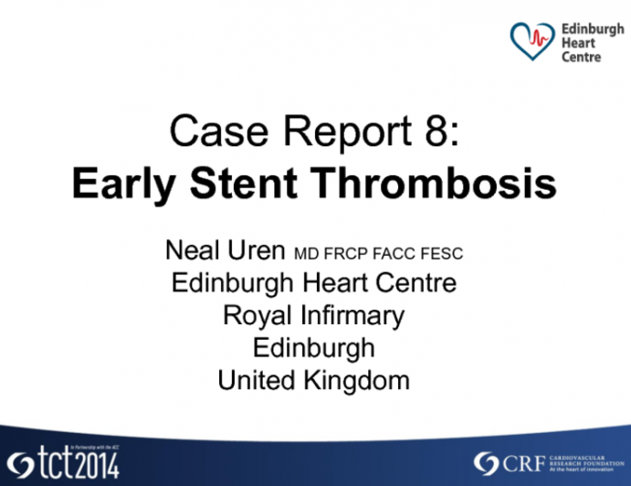 Case #8: Early Stent Thrombosis