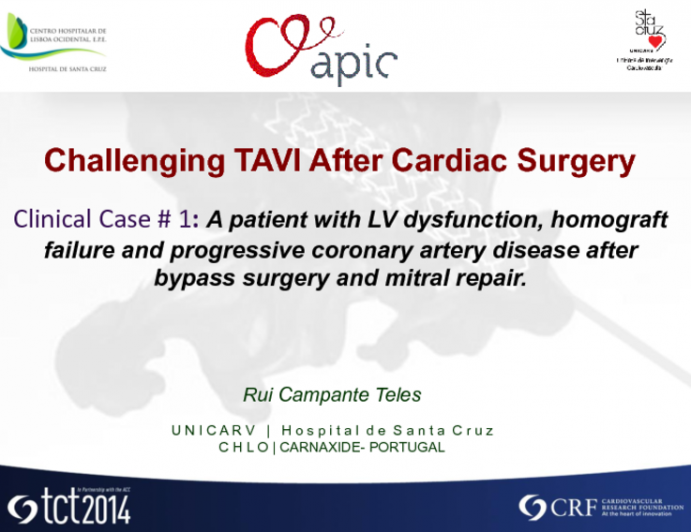 Case #1: A Patient with LV Dysfunction, Homograft Failure, and Progressive Coronary Artery Disease After Bypass Surgery and Mitral Repair