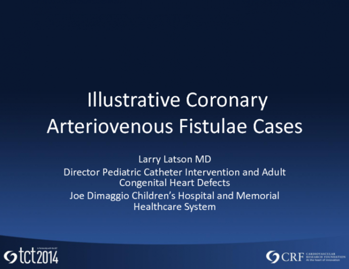 An Illustrative Coronary Arteriovenous Fistulae Case