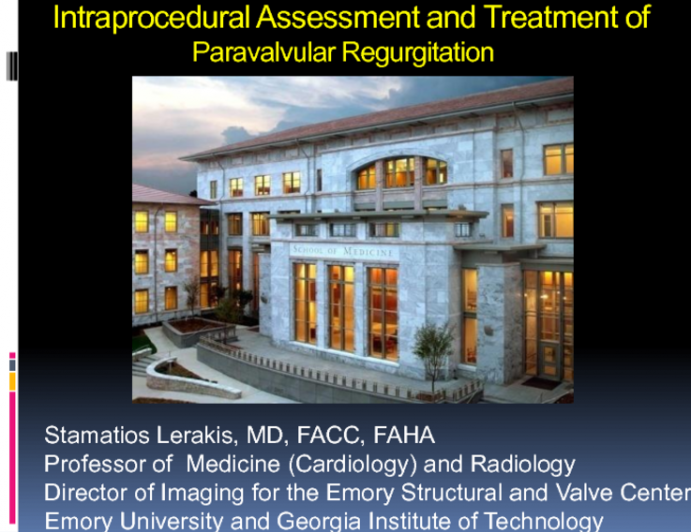 Intraprocedural Assessment and Treatment of Paravalvular Regurgitation