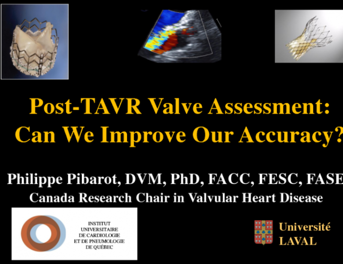 Post-TAVR Valve Assessment: Can We Improve Our Accuracy?