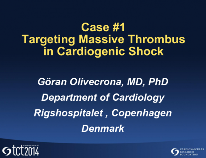 Case #1: Targeting Massive Thrombus in Cardiogenic Shock