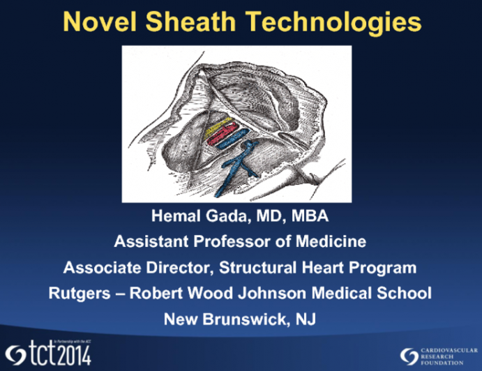 Novel Sheath Technology for TAVR