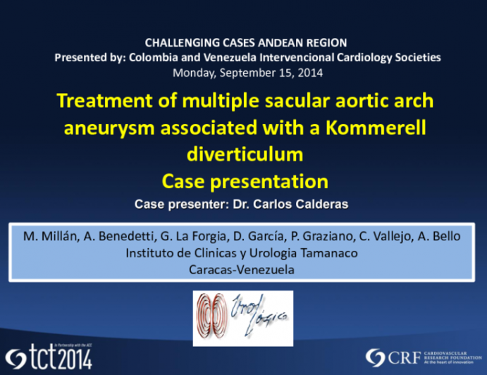 Case #2: A Multisaccular Aortic Arch Aneurysm Associated with a Kommerell Diverticulum