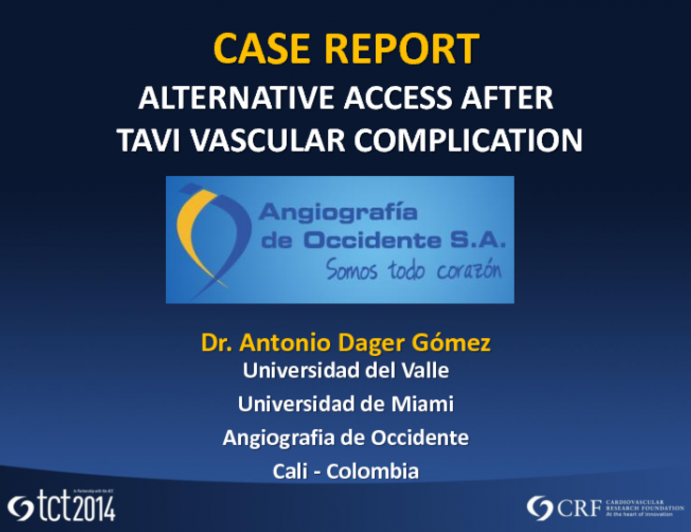 Case #3: A Patient with Aortic Stenosis, Occlusion of the Iliac and Subclavian Arteries, and a Porcelain Aorta