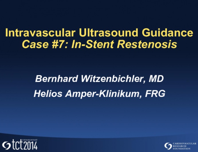 Case #7: In-Stent Restenosis