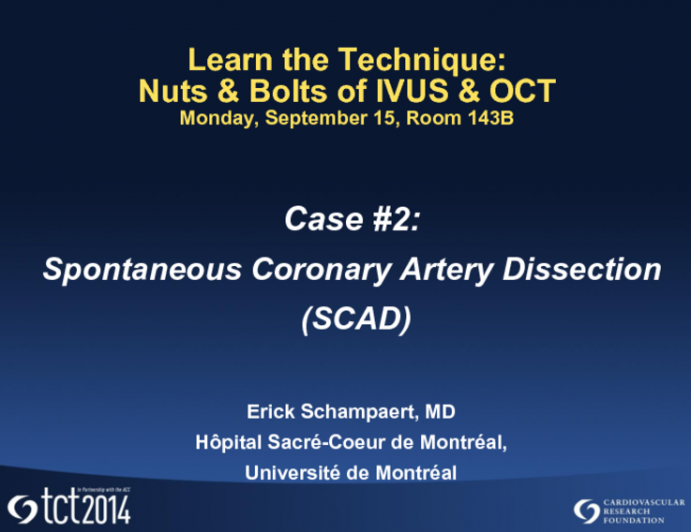 Case #2: Spontaneous Coronary Dissection