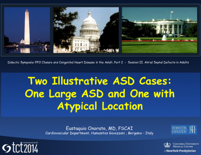 Two Illustrative ASD Cases: One Large ASD and One with Atypical Location