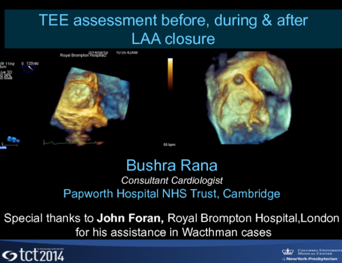 TEE Assessment Before, During, and After LAA Closure