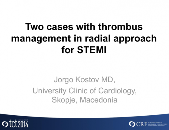 Cases #3 and #4: Two Cases with Thrombus Management During the Radial Approach for STEMI: Routine, Selective, or Never?