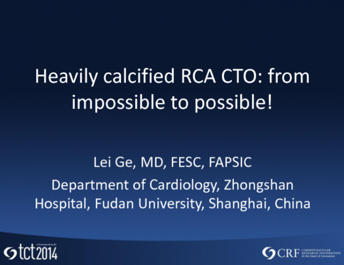 Case #1: Heavily Calcified RCA CTO: From Impossible to Possible!