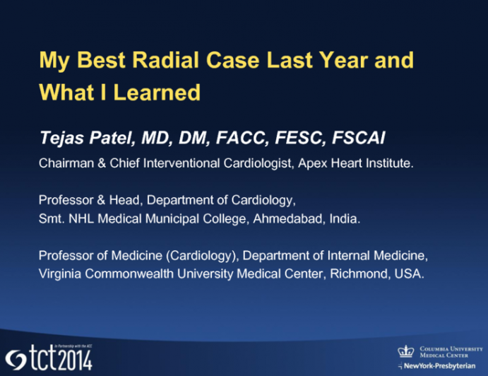 My Best Radial Case Last Year and What I Learned