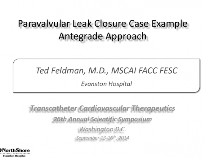 Case #1: Mitral Paravalvular Leak Closure: Antegrade Approach