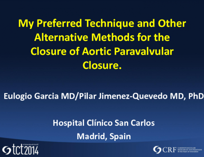 Advanced HT Failure Therapies in 2014: LVAD or Transplant?