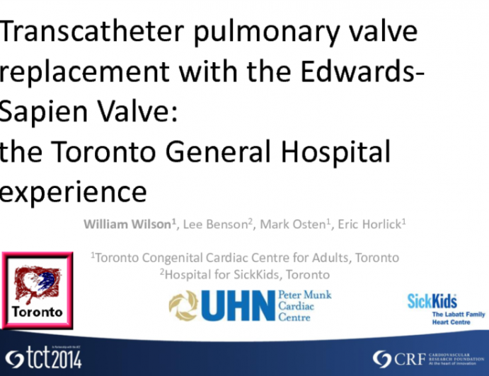 Transcatheter pulmonary valve replacement with the Edwards-Sapien Valve: The Toronto Congenital Cardiac Centre for Adults Experience