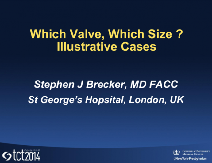 Which Valve, Which Size? Three Illustrative Cases