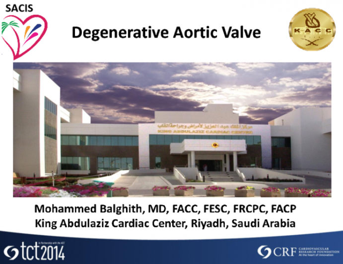 Case #1: A Degenerative Aortic Valve