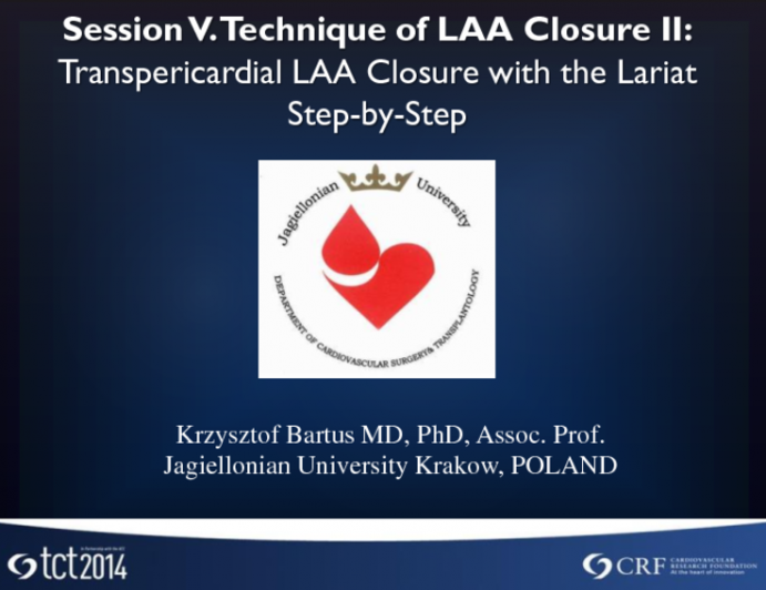 Transpericardial LAA Closure with the Lariat Step-by-Step