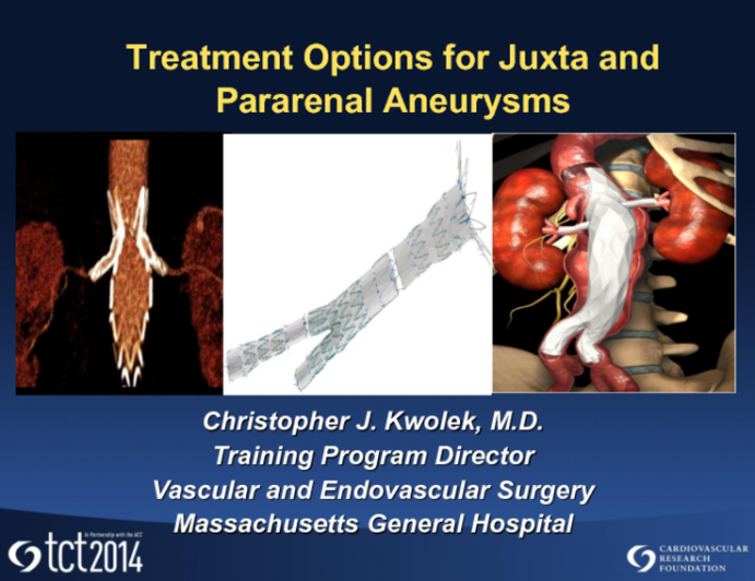 Treatment Options for Juxtarenal and Pararenal Aneurysms