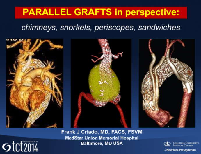 Chimneys, Snorkels, Periscopes, and Sandwiches Continue to Proliferate: Parallel Grafts in Perspective