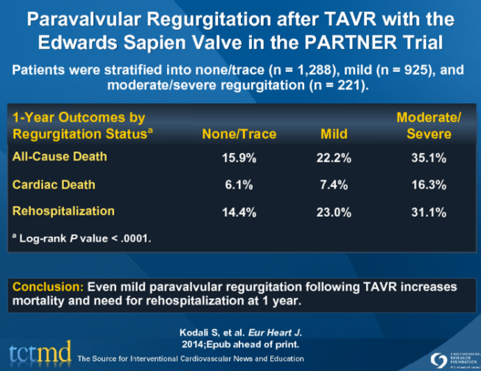 Paravalvular Regurgitation after TAVR with the Edwards Sapien Valve in the PARTNER Trial