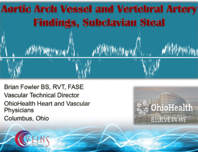 Aortic Arch Vessel and Vertebral Artery Findings, Subclavian Steal