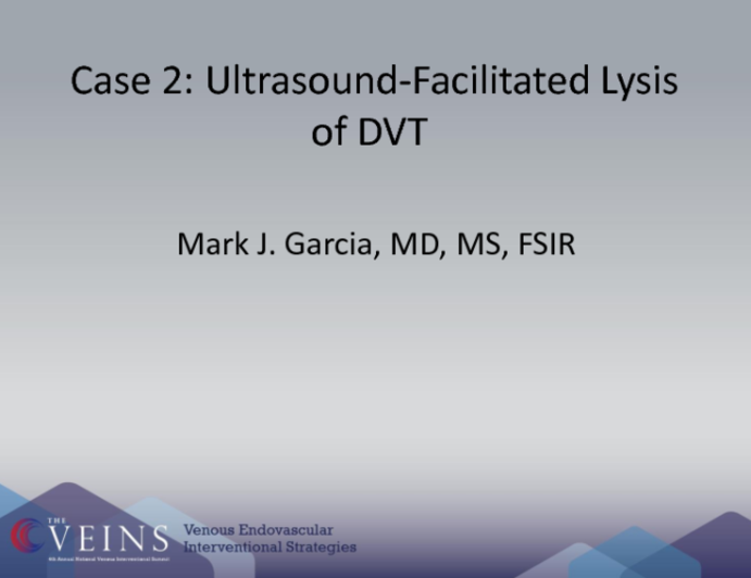 Ultrasound Facilitated Lysis of DVT