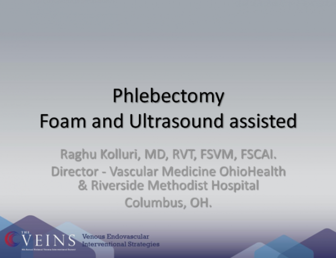 Phlebectomy Foam and Ultrasound Assisted