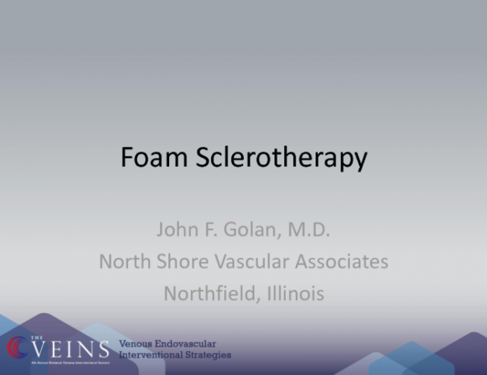 Foam Sclerotherapy