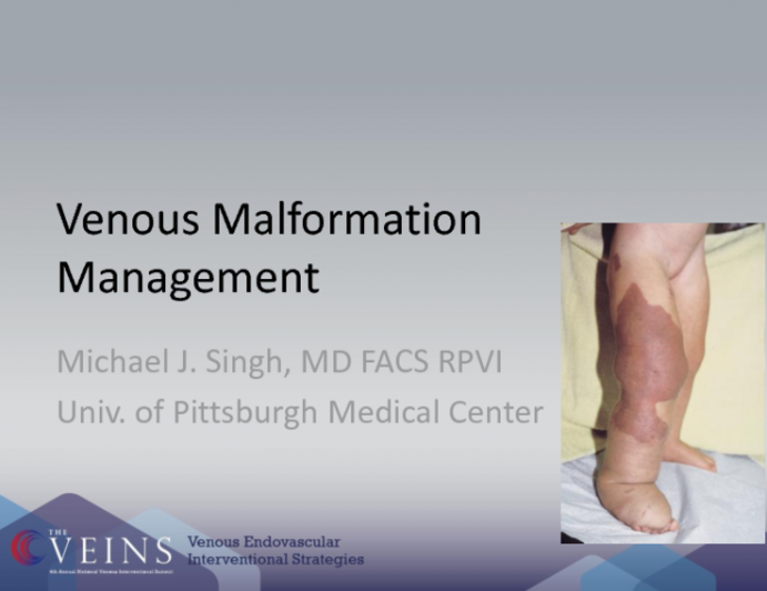 Venous Malformations Management