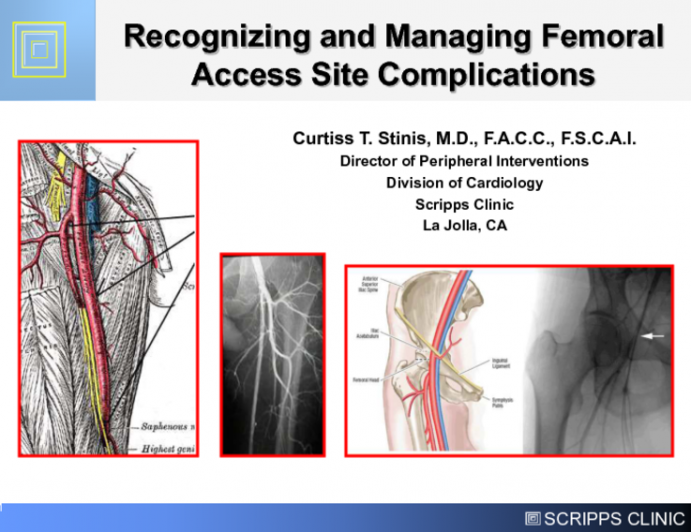 Recognizing and Managing Femoral Access Site Complications