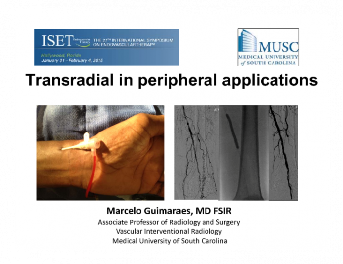 Transradial in Peripheral Applications