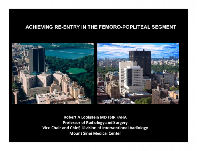 Achieving Re-entry in the Femoral Popliteal Segment