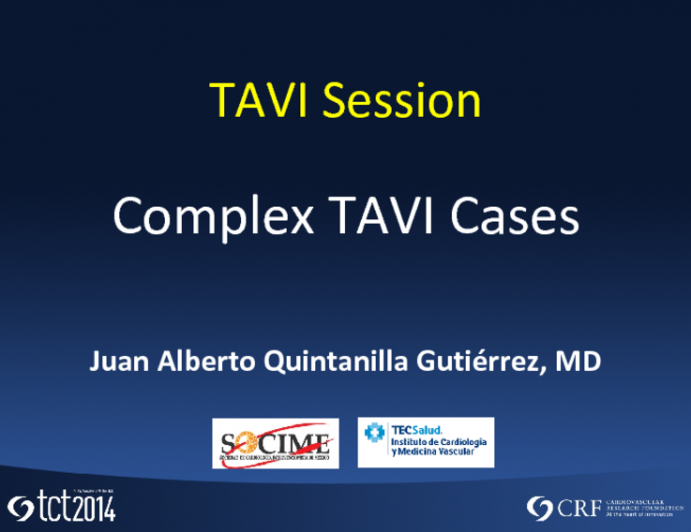 Complex TAVI Cases