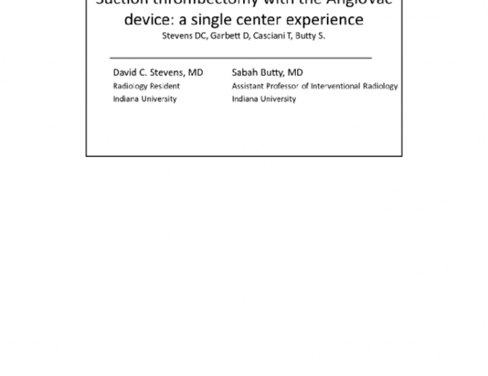 Percutaneous Thrombectomy with the AngioVac Aspiration Device: A Single-Center Experience